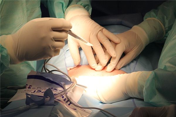 梦见手术是什么意思 梦见手术是什么意思