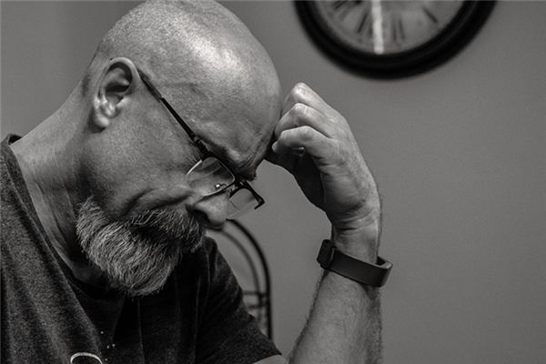 梦见秃顶 梦见秃顶