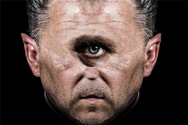 梦见单眼是什么意思 梦见单眼是什么意思