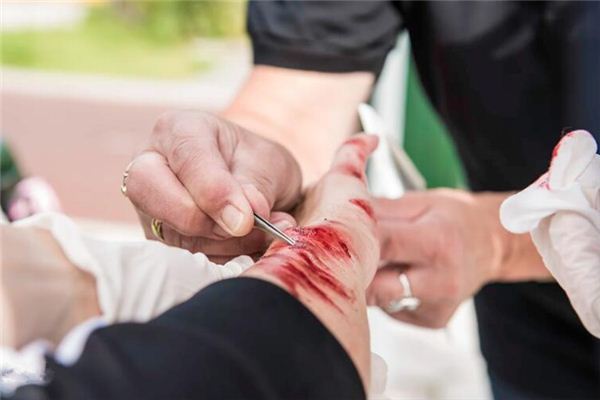 梦见胳膊流血是什么预兆 梦见胳膊流血是什么预兆